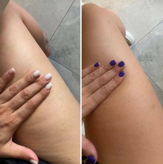 [Оксана Килина] Антидряблость (2022)_0.png